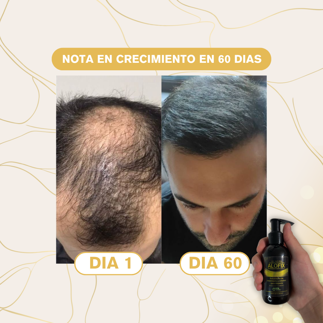Gel de Volumen y Crecimiento Capilar 🧴- 125ml ALOFIX
