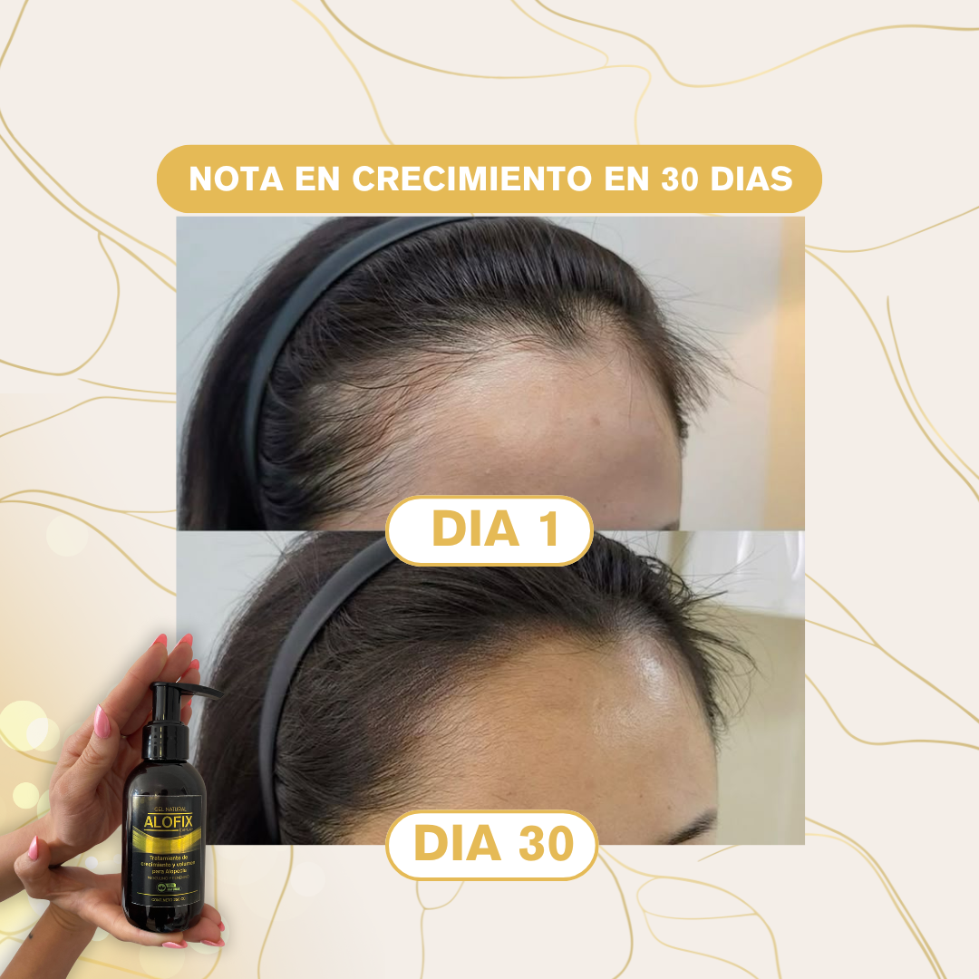 Gel de Volumen y Crecimiento Capilar 🧴- 125ml ALOFIX